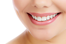 Smile Makeover